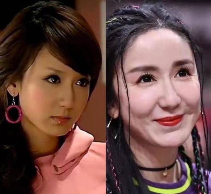 3位過度整容的女明星，面部僵硬很怪異，因動臉毀了自己的事業 - 娛樂 - iNewsDB 日日新聞．掌握每日新鮮事